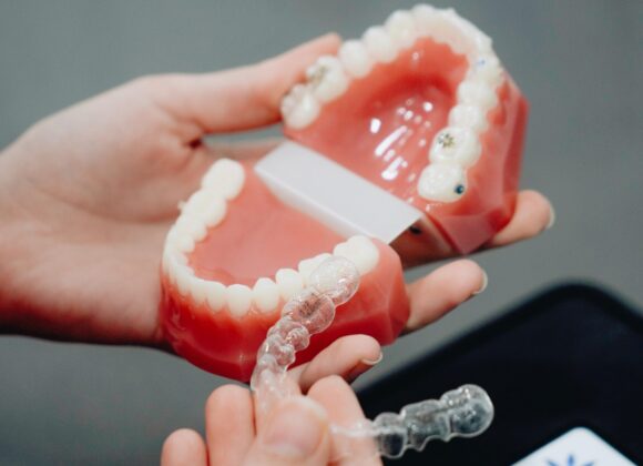 Invisalign or Braces: Which is right for you?